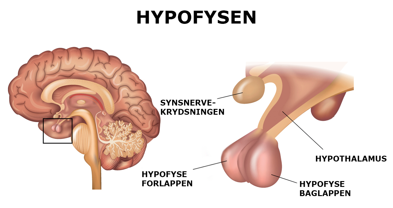 Hypofysen