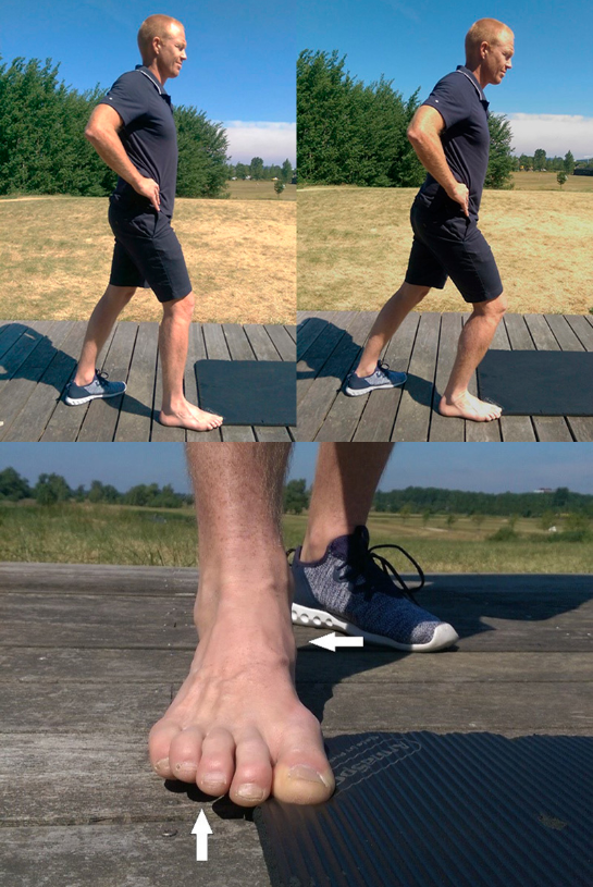 Øvelse 3: Fodens stilling set forfra. Pilene viser, hvordan de fire yderste tæer er løftet, og hvordan foden holdes ret i forhold til underbenet, så anklen ikke falder indad.